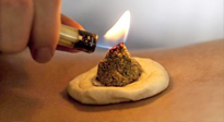 【艾灸知識(shí)】十大常見艾灸不良反應(yīng)，及處理方法！建議收藏！